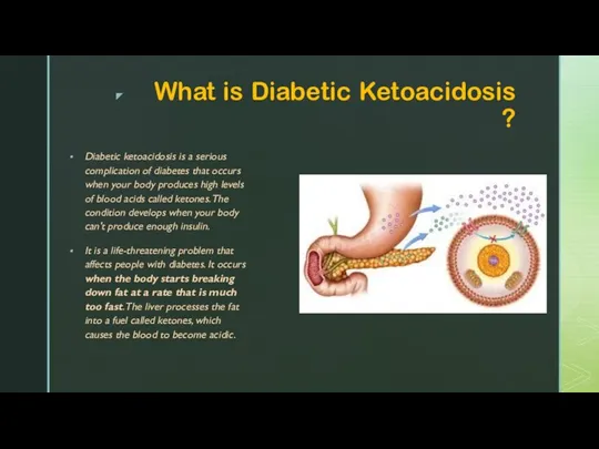 What is Diabetic Ketoacidosis ? Diabetic ketoacidosis is a serious complication