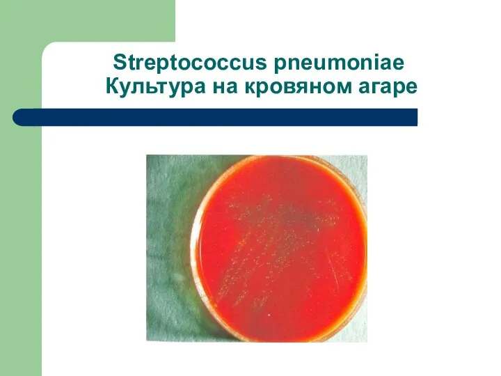 Streptococcus pneumoniae Культура на кровяном агаре