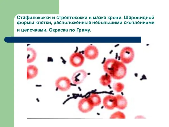 Стафилококки и стрептококки в мазке крови. Шаровидной формы клетки, расположенные небольшими