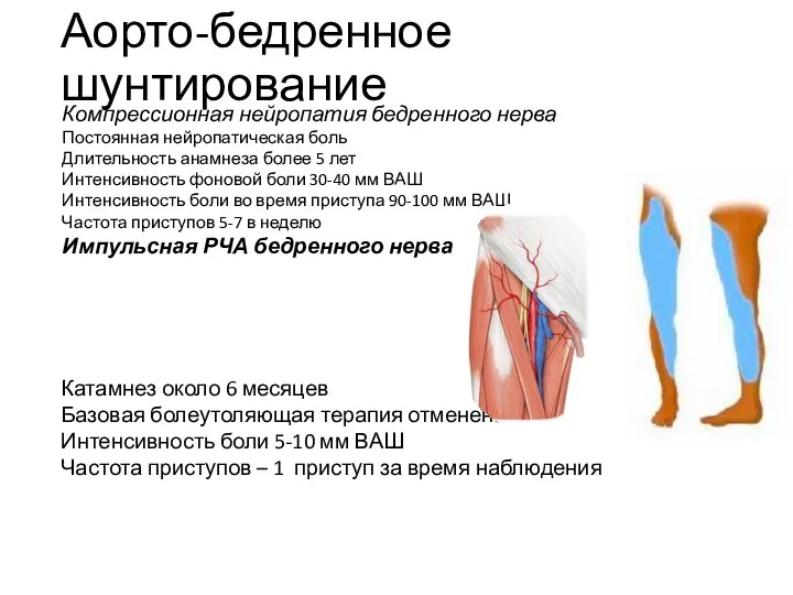 Аорто-бедренное шунтирование Катамнез около 6 месяцев Базовая болеутоляющая терапия отменена Интенсивность