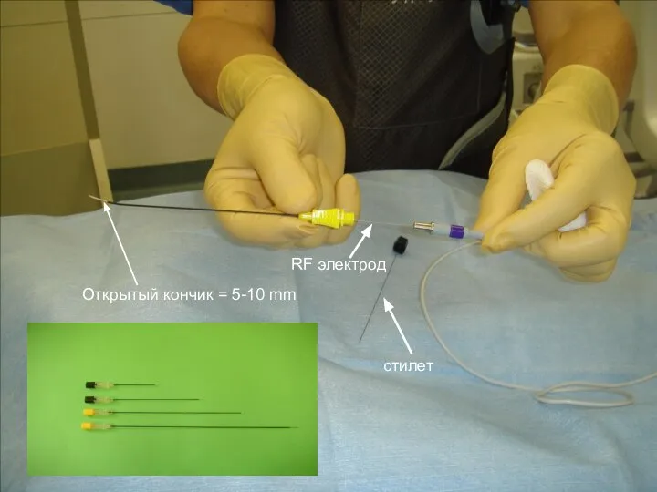 стилет Открытый кончик = 5-10 mm RF электрод
