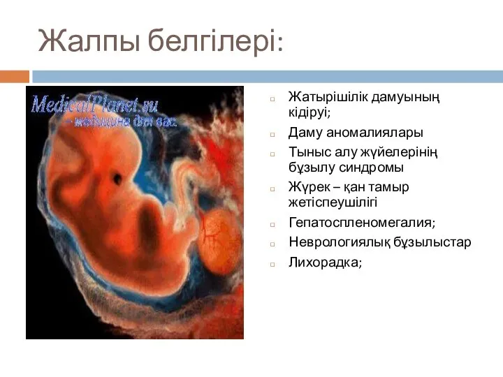 Жалпы белгілері: Жатырішілік дамуының кідіруі; Даму аномалиялары Тыныс алу жүйелерінің бұзылу