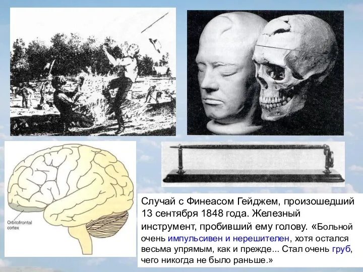 Случай с Финеасом Гейджем, произошедший 13 сентября 1848 года. Железный инструмент,