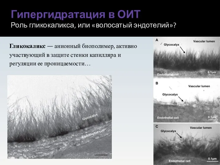 Гипергидратация в ОИТ Роль гликокаликса, или «волосатый эндотелий»? Гликокаликс — анионный