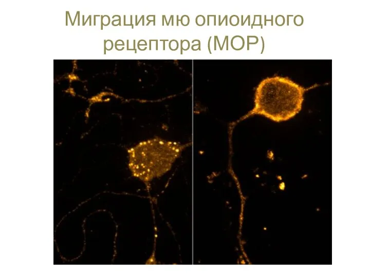 Миграция мю опиоидного рецептора (МОР)