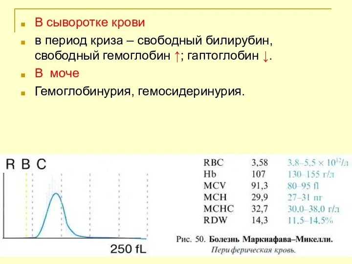 В сыворотке крови в период криза – свободный билирубин, свободный гемоглобин