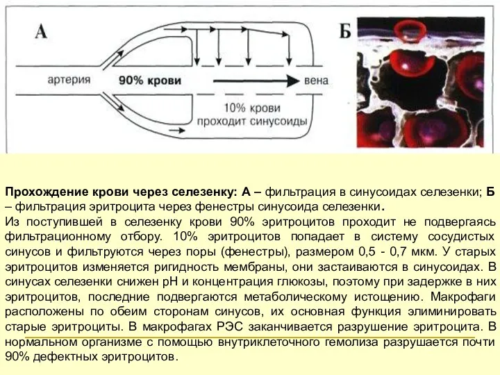 Прохождение крови через селезенку: А – фильтрация в синусоидах селезенки; Б