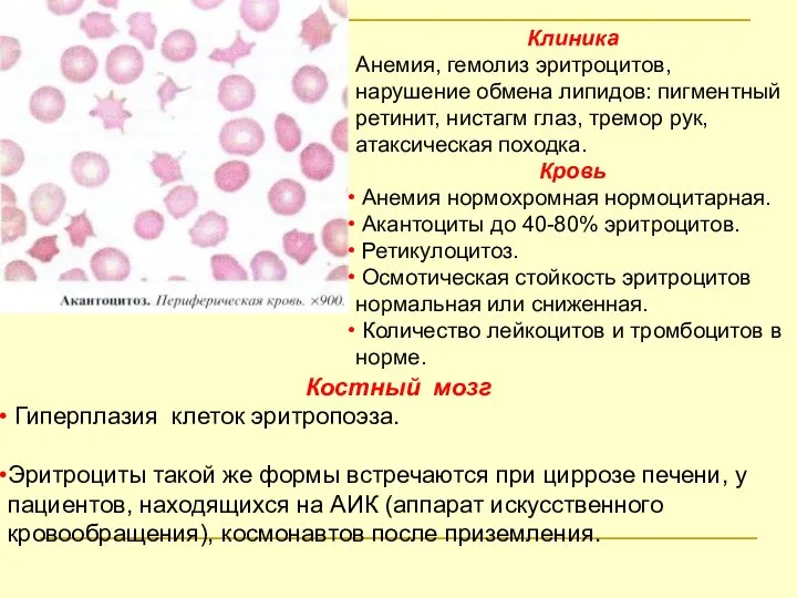 Клиника Анемия, гемолиз эритроцитов, нарушение обмена липидов: пигментный ретинит, нистагм глаз,