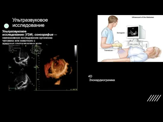 Ультразвуковое исследование Ультразвуковое исследование (УЗИ), сонография — неинвазивное исследование организма человека