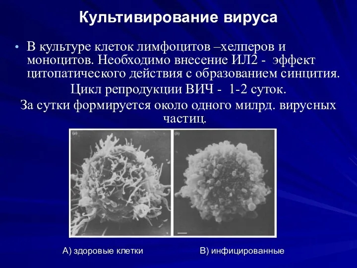 Культивирование вируса В культуре клеток лимфоцитов –хелперов и моноцитов. Необходимо внесение