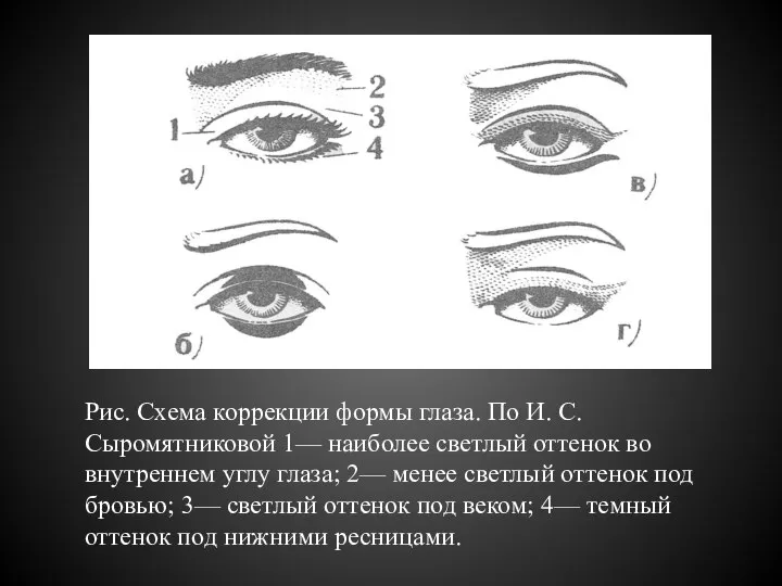 Рис. Схема коррекции формы глаза. По И. С. Сыромятниковой 1— наиболее