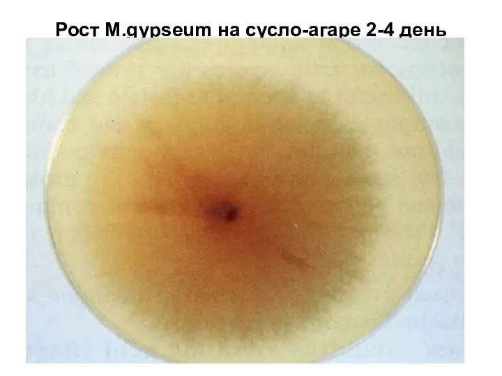 Рост М.gypseum на сусло-агаре 2-4 день