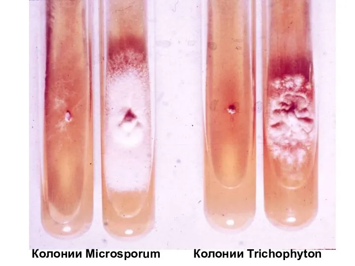 Колонии Microsporum Колонии Trichophyton