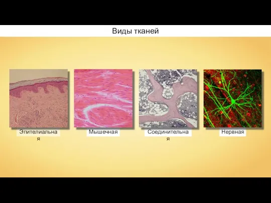 Мышечная Эпителиальная Соединительная Нервная Виды тканей