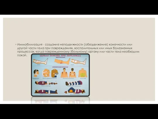 Иммобилизация - создание неподвижности (обездвижение) конечности или другой части тела при