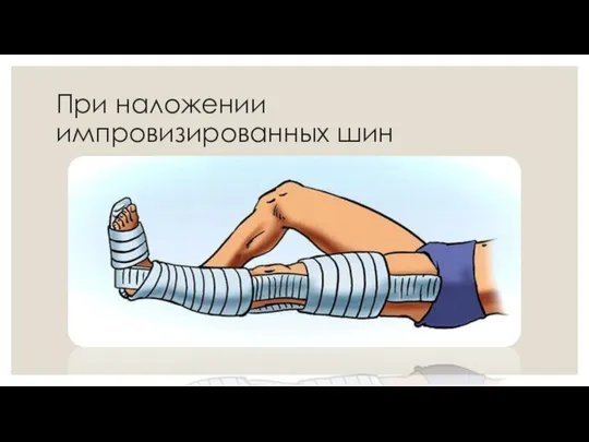 При наложении импровизированных шин