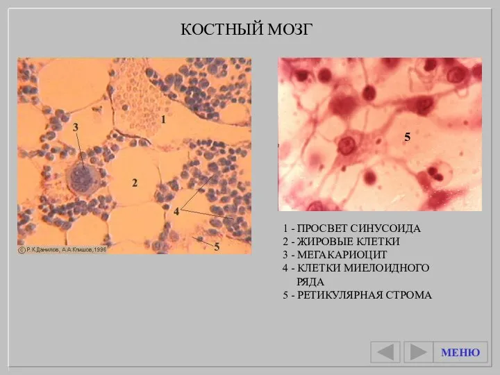 1 - ПРОСВЕТ СИНУСОИДА 2 - ЖИРОВЫЕ КЛЕТКИ 3 - МЕГАКАРИОЦИТ