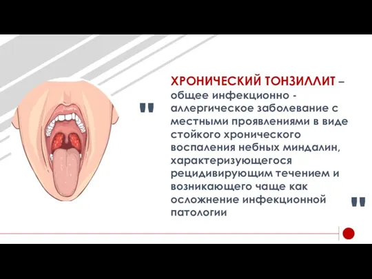 ХРОНИЧЕСКИЙ ТОНЗИЛЛИТ – общее инфекционно -аллергическое заболевание с местными проявлениями в