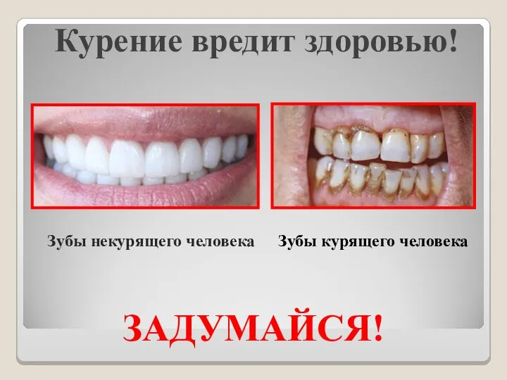 Курение вредит здоровью! Зубы некурящего человека Зубы курящего человека ЗАДУМАЙСЯ!