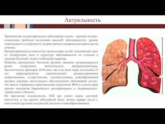 Актуальность Хронические неспецифические заболевания легких - крупная медико-социальная проблема вследствие высокой