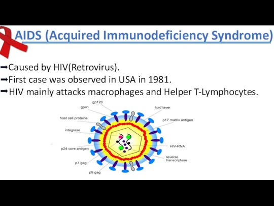 AIDS (Acquired Immunodeficiency Syndrome) Caused by HIV(Retrovirus). First case was observed