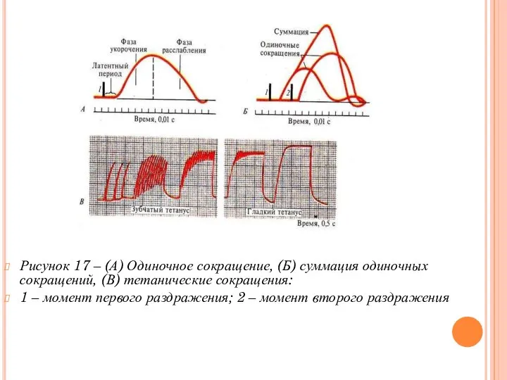 Рисунок 17 – (А) Одиночное сокращение, (Б) суммация одиночных сокращений, (В)