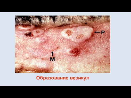 Образование везикул