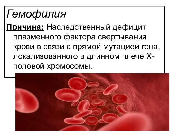 Гемофилия Причина: Наследственный дефицит плазменного фактора свертывания крови в связи с