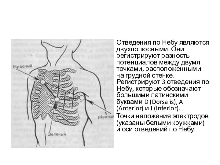 Отведения по Небу являются двухполюсными. Они регистрируют разность потенциалов между двумя