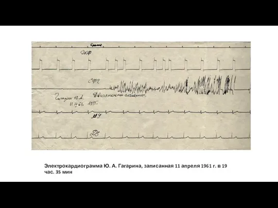 Электрокардиограмма Ю. А. Гагарина, записанная 11 апреля 1961 г. в 19 час. 35 мин