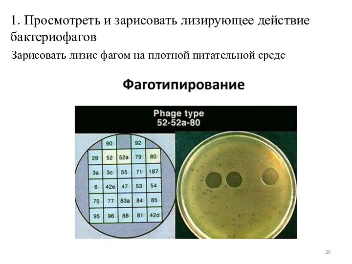 Зарисовать лизис фагом на плотной питательной среде 1. Просмотреть и зарисовать лизирующее действие бактериофагов