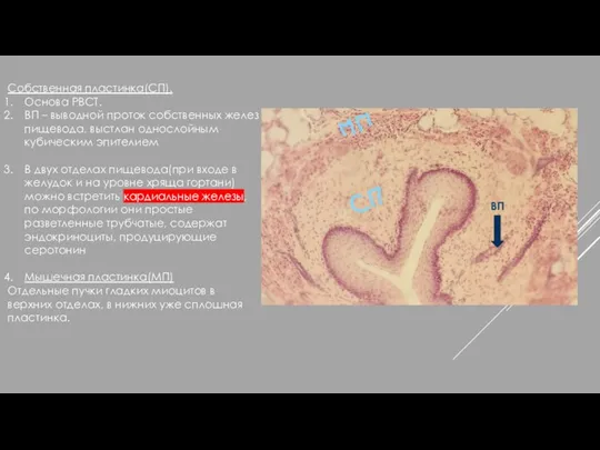 Собственная пластинка(СП). Основа РВСТ. ВП – выводной проток собственных желез пищевода,