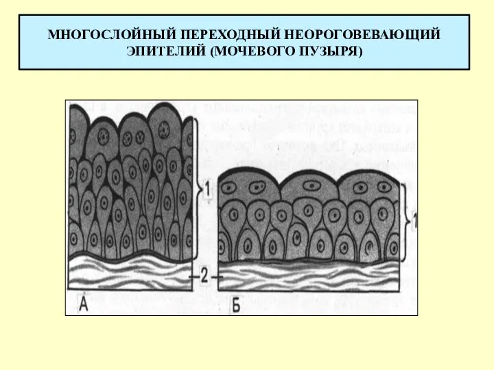 МНОГОСЛОЙНЫЙ ПЕРЕХОДНЫЙ НЕОРОГОВЕВАЮЩИЙ ЭПИТЕЛИЙ (МОЧЕВОГО ПУЗЫРЯ)