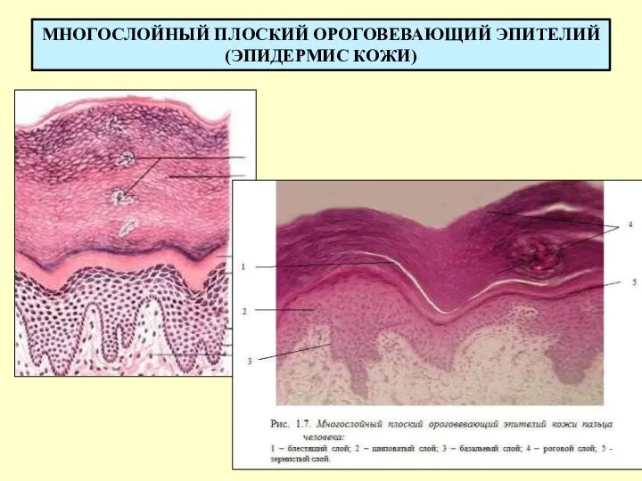 МНОГОСЛОЙНЫЙ ПЛОСКИЙ ОРОГОВЕВАЮЩИЙ ЭПИТЕЛИЙ (ЭПИДЕРМИС КОЖИ)