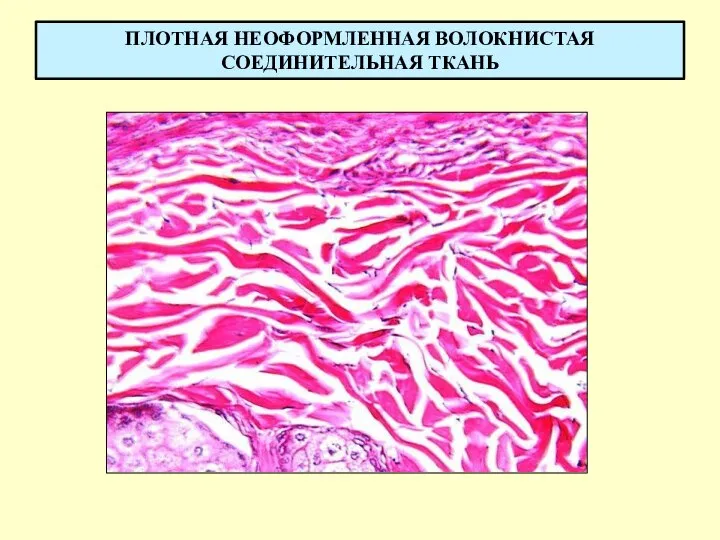 ПЛОТНАЯ НЕОФОРМЛЕННАЯ ВОЛОКНИСТАЯ СОЕДИНИТЕЛЬНАЯ ТКАНЬ