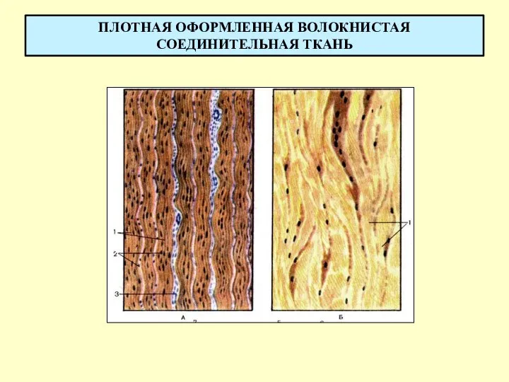 ПЛОТНАЯ ОФОРМЛЕННАЯ ВОЛОКНИСТАЯ СОЕДИНИТЕЛЬНАЯ ТКАНЬ