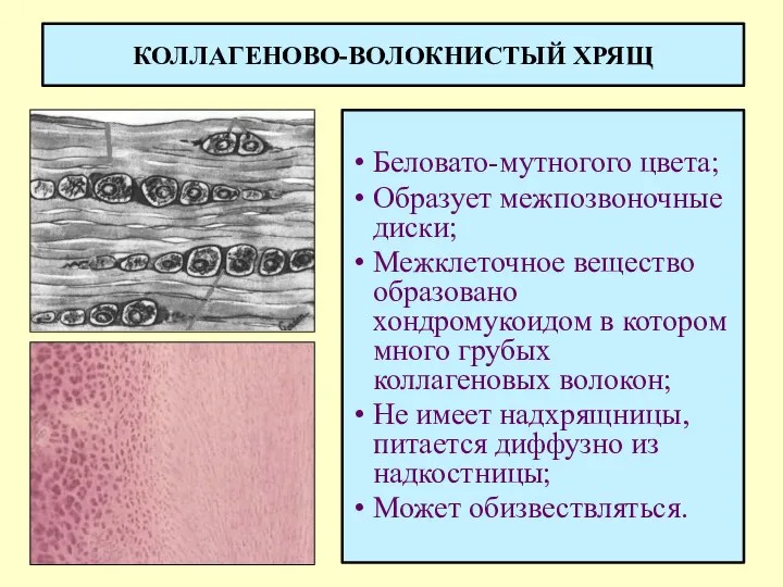 КОЛЛАГЕНОВО-ВОЛОКНИСТЫЙ ХРЯЩ Беловато-мутногого цвета; Образует межпозвоночные диски; Межклеточное вещество образовано хондромукоидом