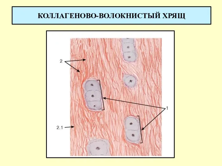 КОЛЛАГЕНОВО-ВОЛОКНИСТЫЙ ХРЯЩ