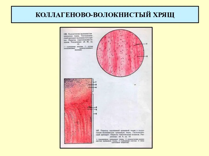 КОЛЛАГЕНОВО-ВОЛОКНИСТЫЙ ХРЯЩ