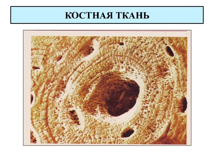 КОСТНАЯ ТКАНЬ