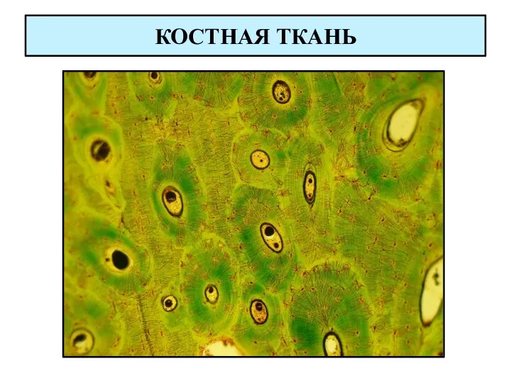 КОСТНАЯ ТКАНЬ