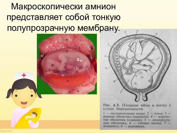 Макроскопически амнион представляет собой тонкую полупрозрачную мембрану.