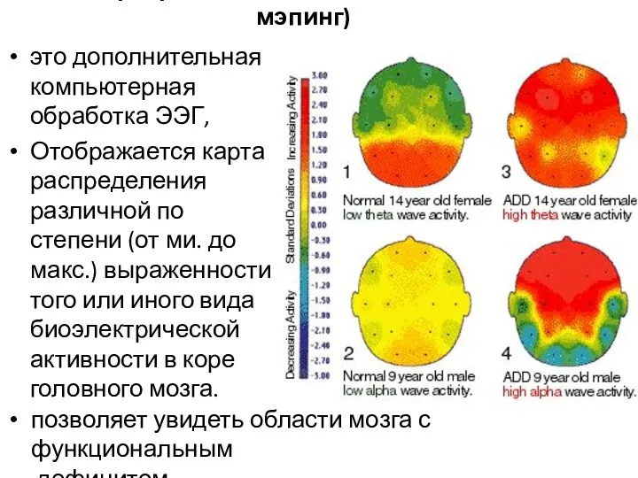 ЭЭГ картирование головного мозга (maping - мэпинг) это дополнительная компьютерная обработка