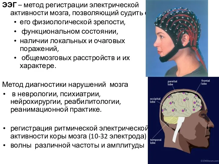 ЭЭГ – метод регистрации электрической активности мозга, позволяющий судить о его