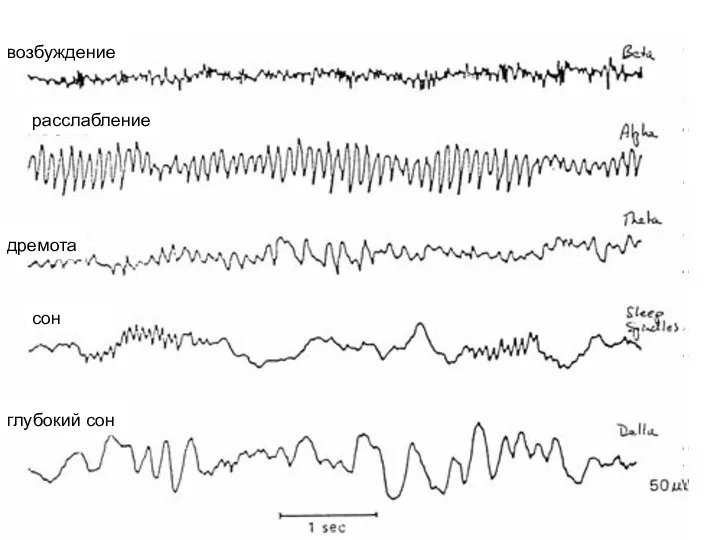 возбуждение возбуждение сон глубокий сон расслабление дремота возбуждение
