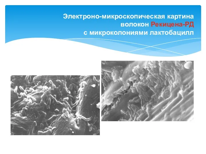 Электроно-микроскопическая картина волокон Рекицена-РД с микроколониями лактобацилл
