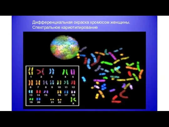Дифференциальная окраска хромосом женщины. Спектральное кариотипирование