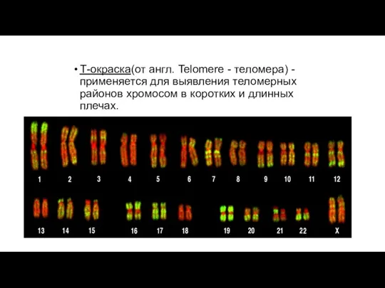 Т-окраска(от англ. Telomere - теломера) - применяется для выявления теломерных районов