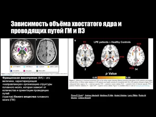 Зависимость объёма хвостатого ядра и проводящих путей ГМ и ПЭ Фракционная