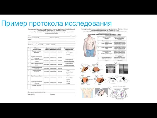 Пример протокола исследования